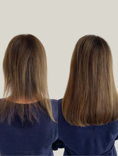 Why Use Extensions for Thinning Hair?