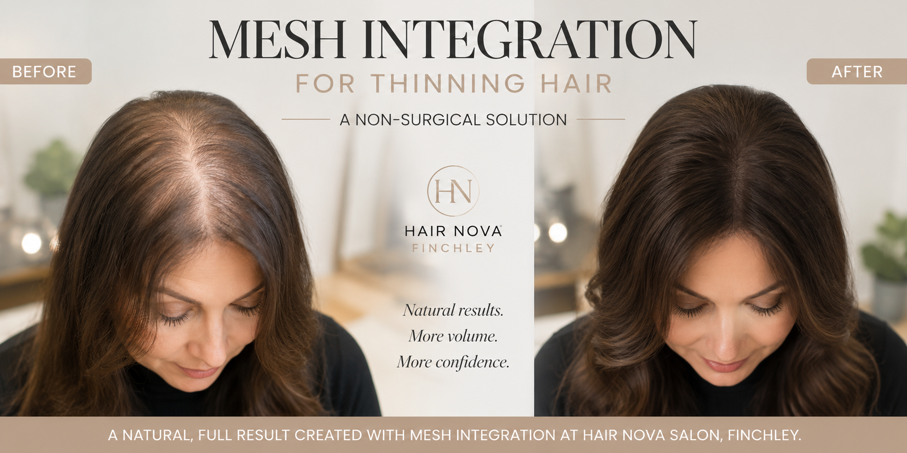Mesh integration for thinning hair result at Hair Nova Salon Finchley